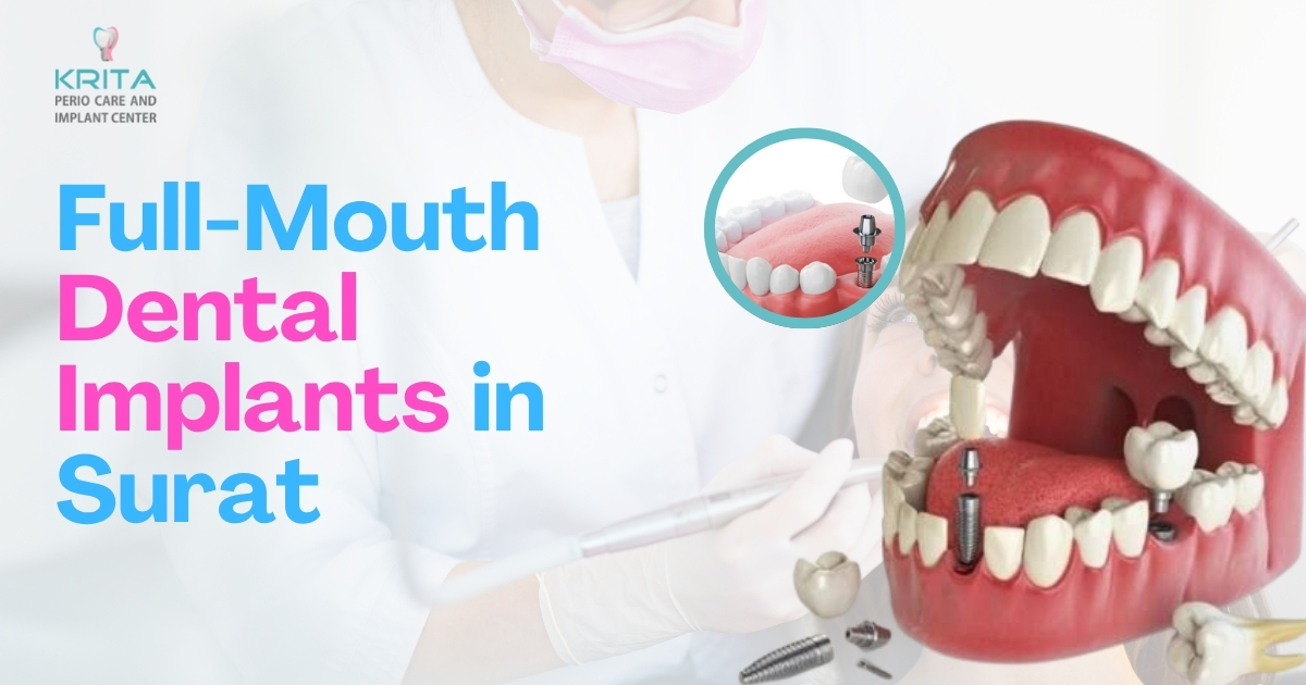 Full Mouth Dental Implants in Surat