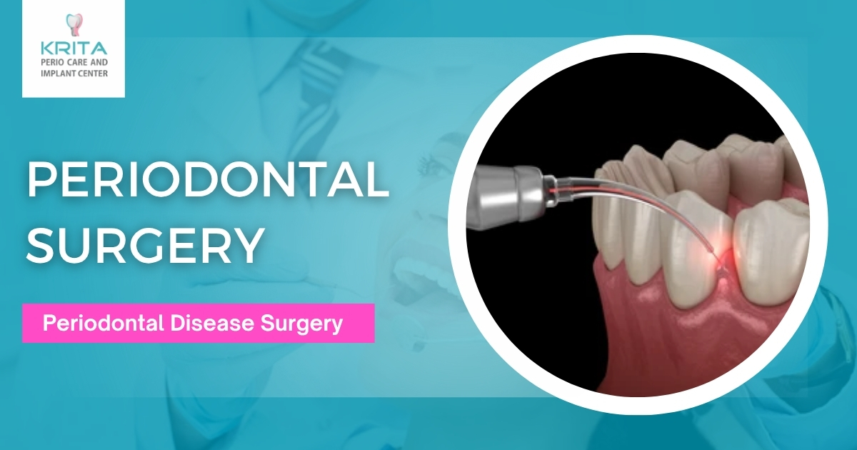 Periodontal Surgery