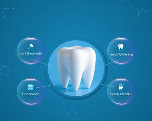 periodental img implant placement