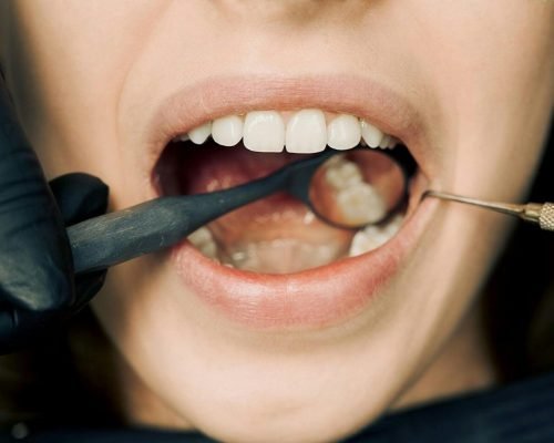 pexels-photo-12148417-12148417 Close-up of a dental examination with modern equipment, showcasing oral hygiene maintenance.